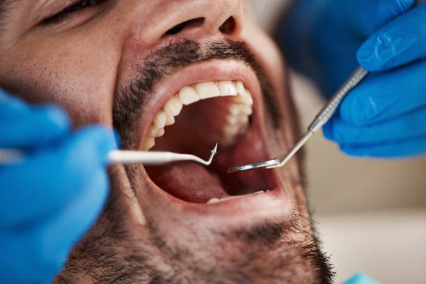 Best Walk-In Emergency Dentist in Burlington, KY