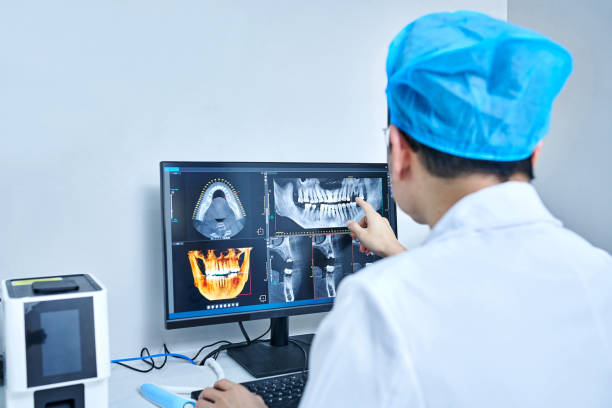 Best Emergency Tooth Extraction in Burlington, KY